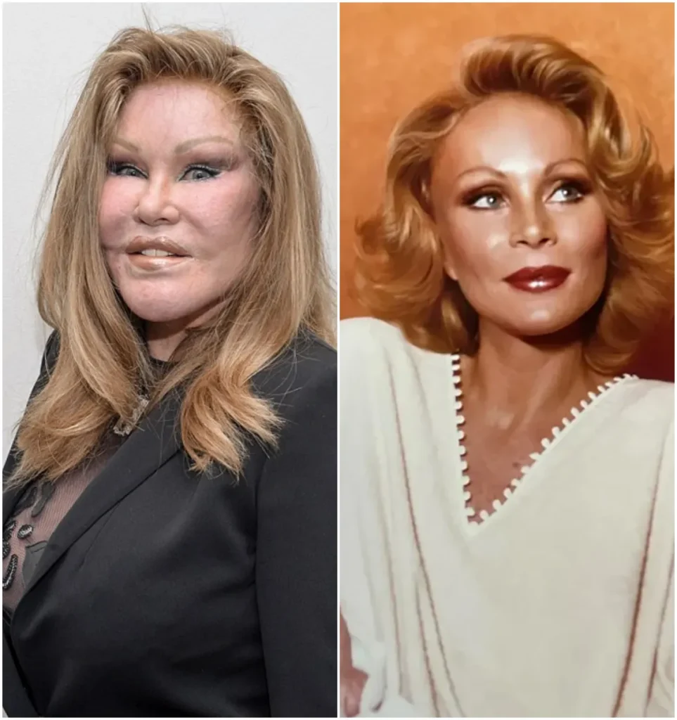 ‘Catwoman’ Jocelyn Wildenstein Shocks with Before and After Plastic Surgery Photos